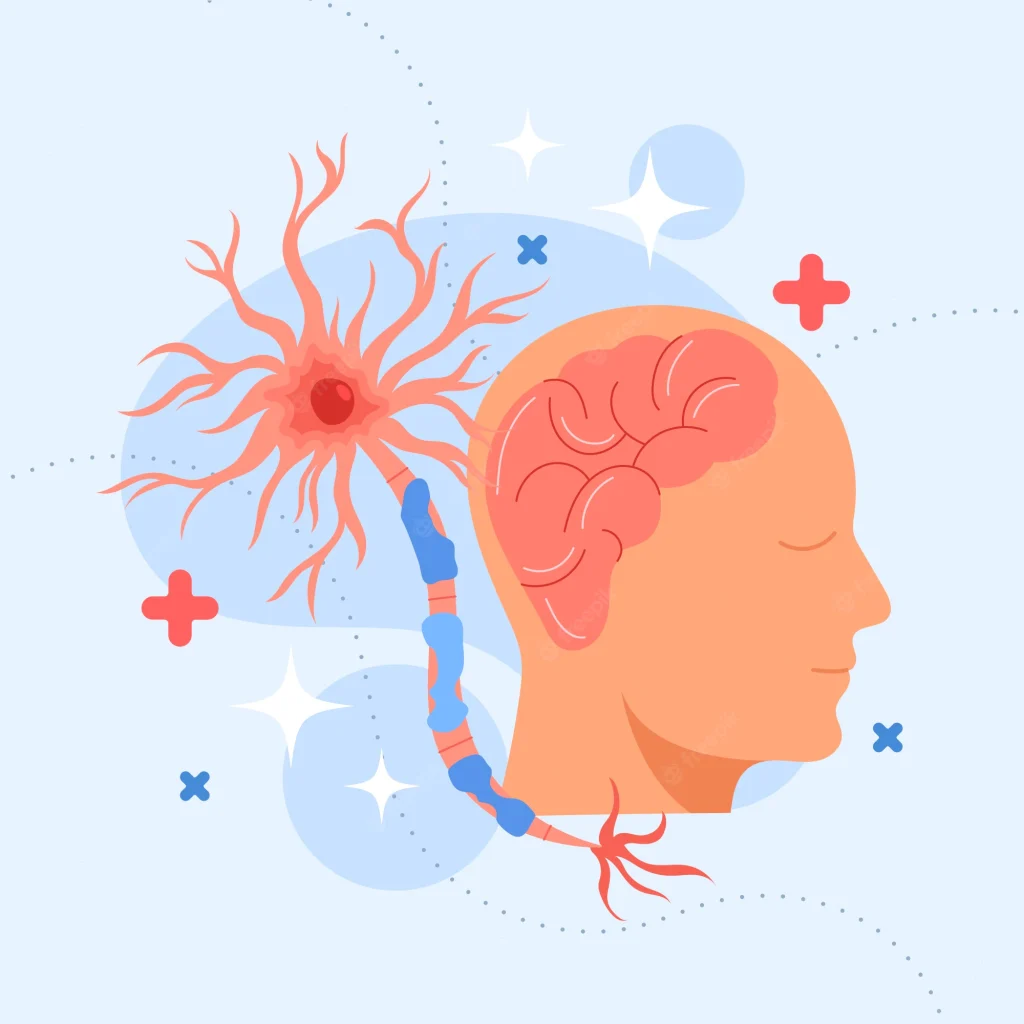 بیماری ام‌اس