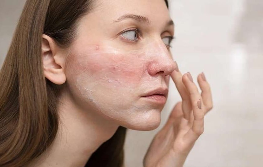 معرفی بهترین روش های مراقبت و پیشگیری از بیماری های پوستی